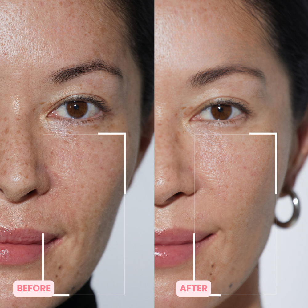 Skinnovate™ Sculpt & Tone Arm Cream