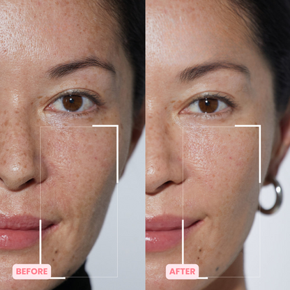 Skinnovate™ Sculpt & Tone Arm Cream