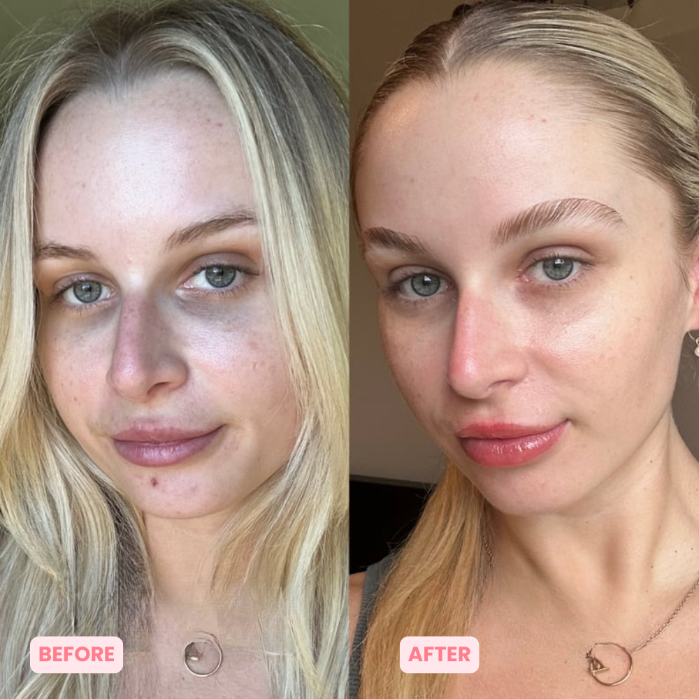 Skinnovate™ Sculpt & Tone Arm Cream