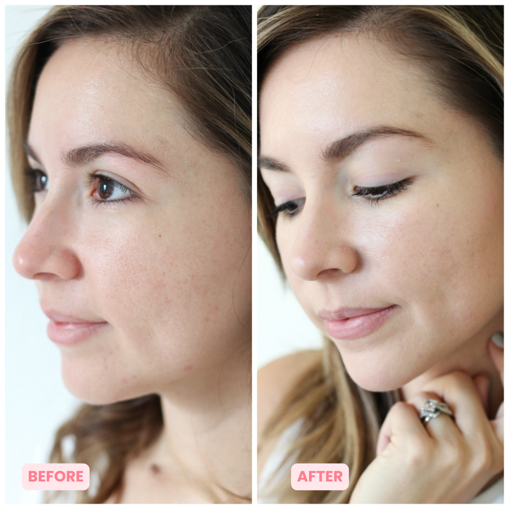 Skinnovate™ Sculpt & Tone Arm Cream