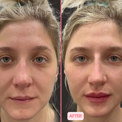 MicroGlow Eye Patches