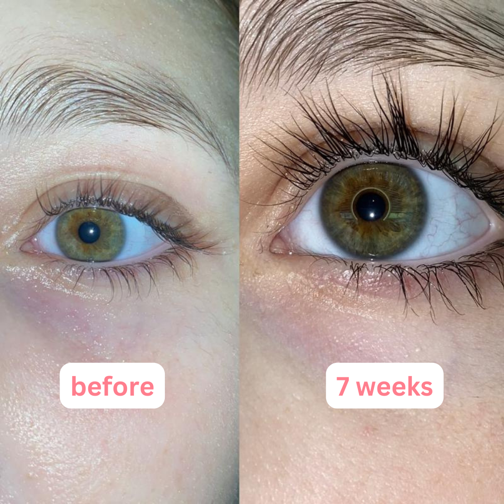 Eyelash Growth Serum