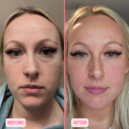 MicroGlow Eye Patches