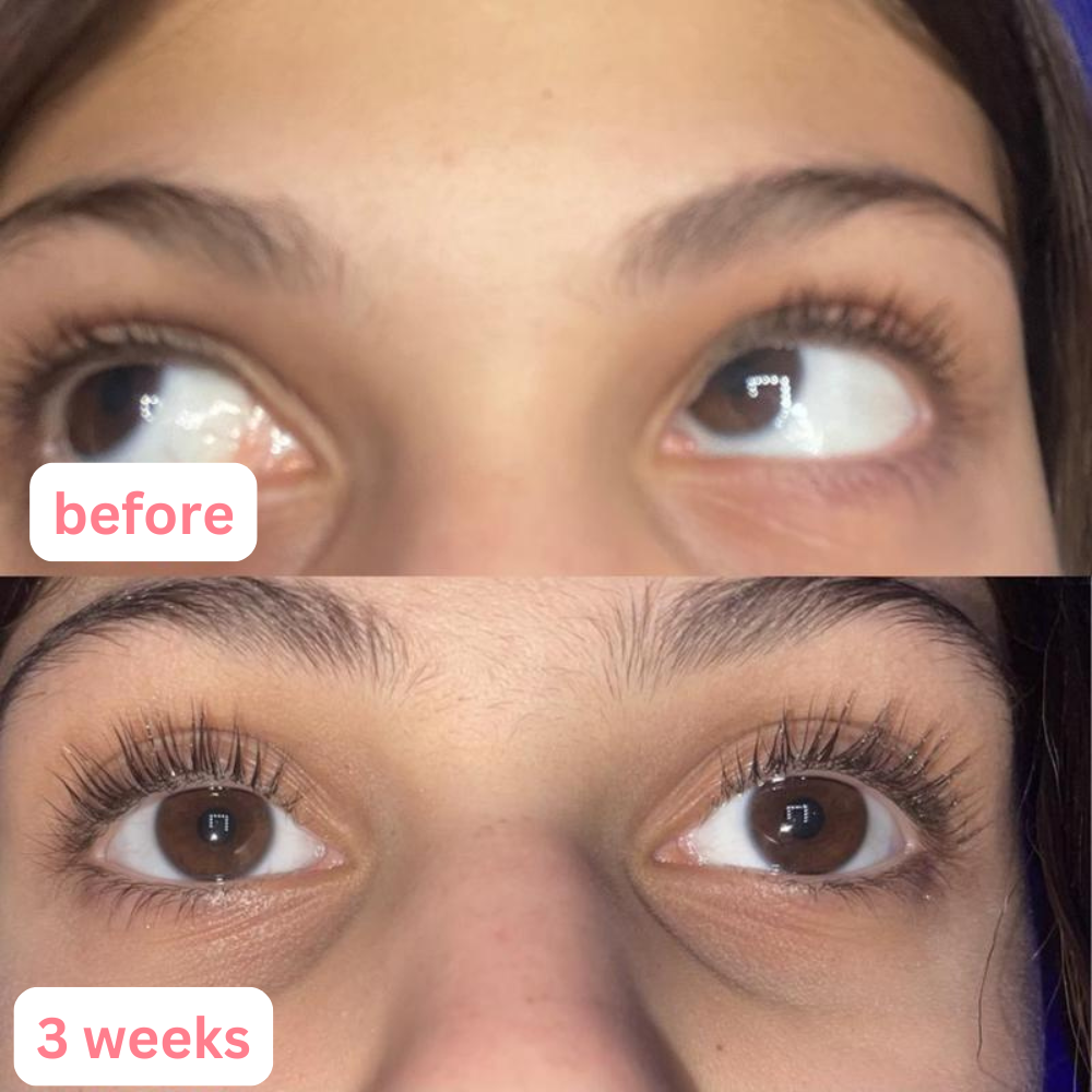 Eyelash Growth Serum