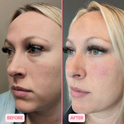 MicroGlow Eye Patches