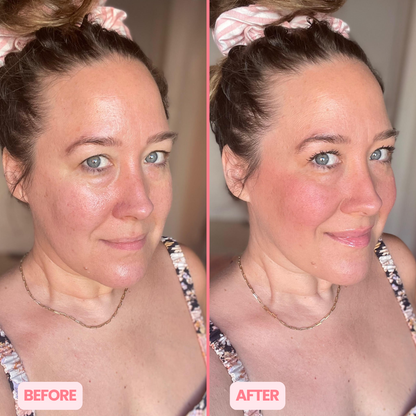 MicroGlow Eye Patches