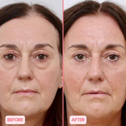 MicroGlow Eye Patches