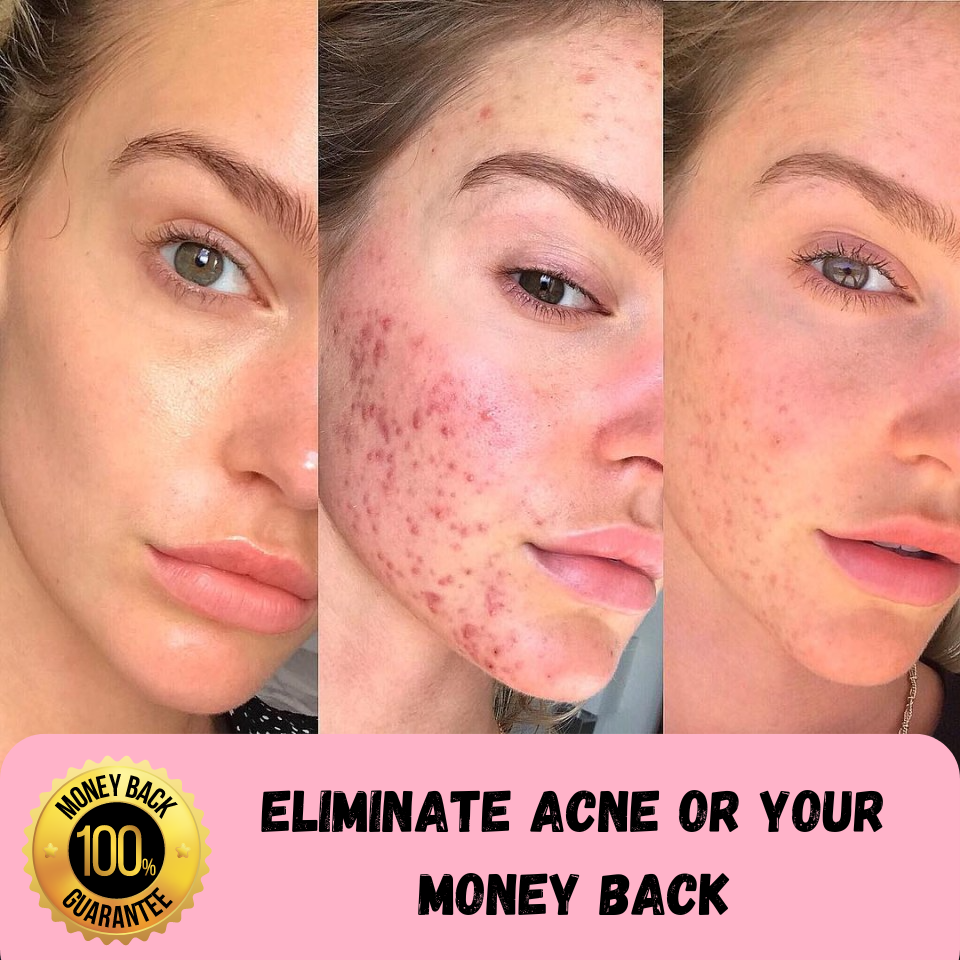 DermaWand 2.0 - 4 in 1 High Frequency Wand