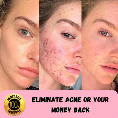 DermaWand 2.0 - 4 in 1 High Frequency Wand